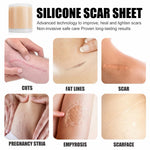 Silicone Scar Sheet