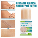 Silicone Scar Sheet