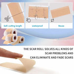 Silicone Scar Sheet