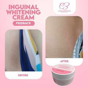 Inguinal (Singit) Cream