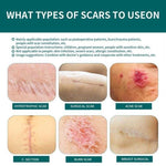 Silicone Scar Sheet