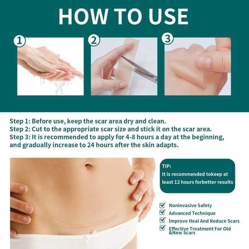 Silicone Scar Sheet – Homenurture PH