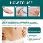 Silicone Scar Sheet
