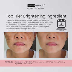 Alpha Arbutin Ultra White Serum
